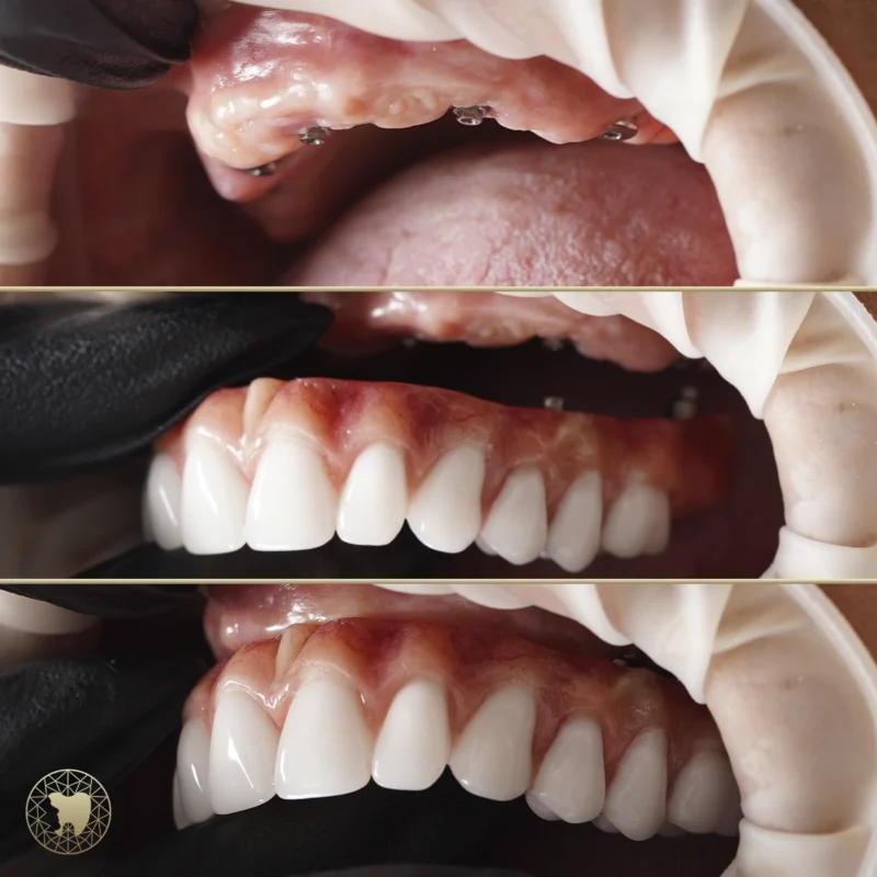 fotografia_odontologica_1