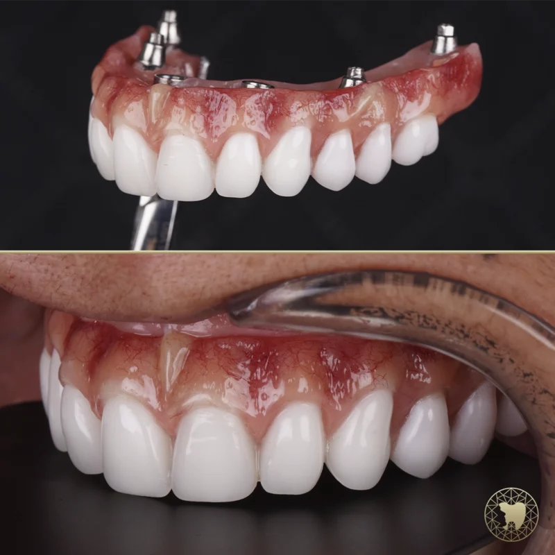 fotografia_odontologica_3
