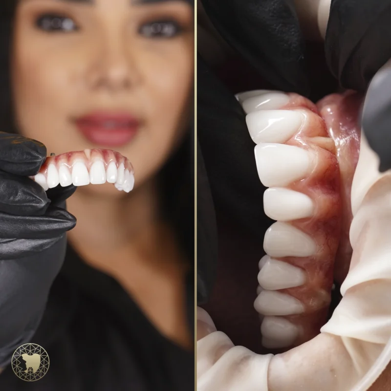fotografia_odontologica_6