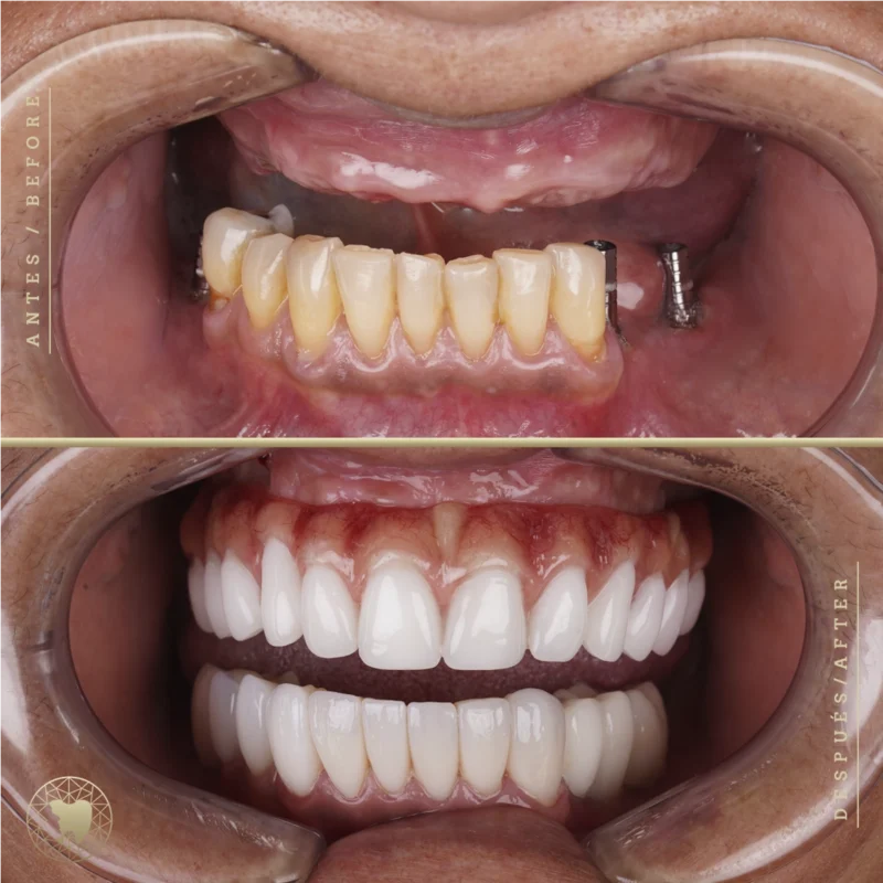 fotografia_odontologica_7