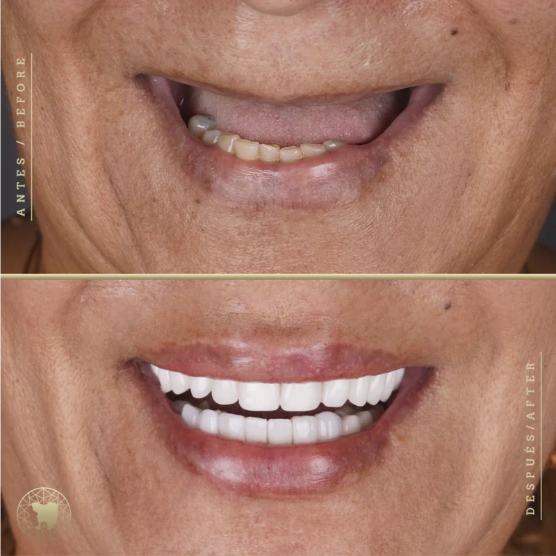 fotografia_odontologica_8